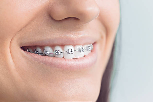 Best Invisalign and Clear Aligners  in Blackwells Mills, NJ